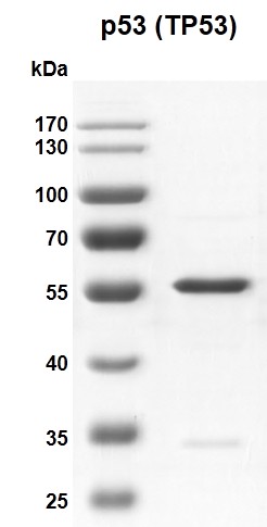 10% SDS-PAGE Coomassie staining